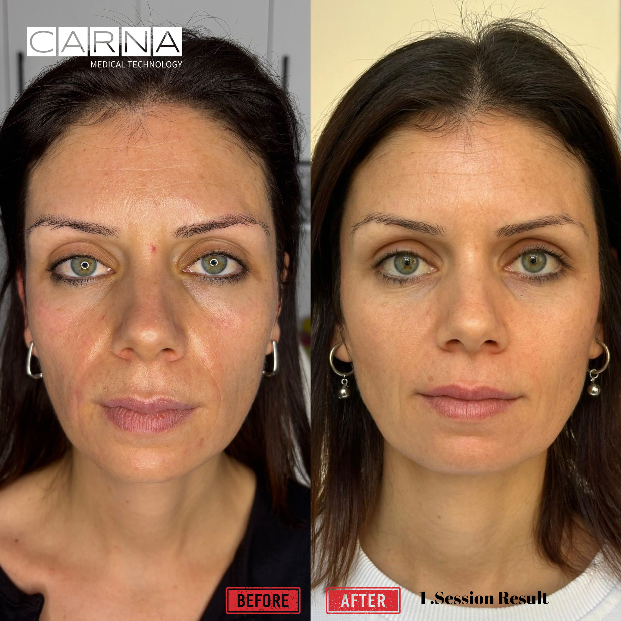 fusion plasma 1 . Session Result