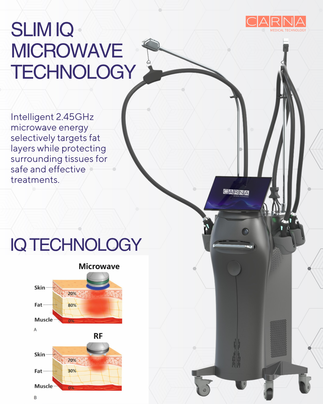 Slim IQ Microwave Technology Slim iq microwave technology