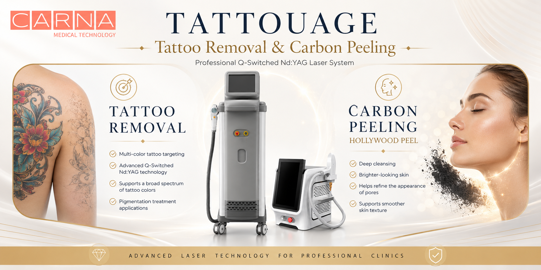 carbon peelin tattoo removal